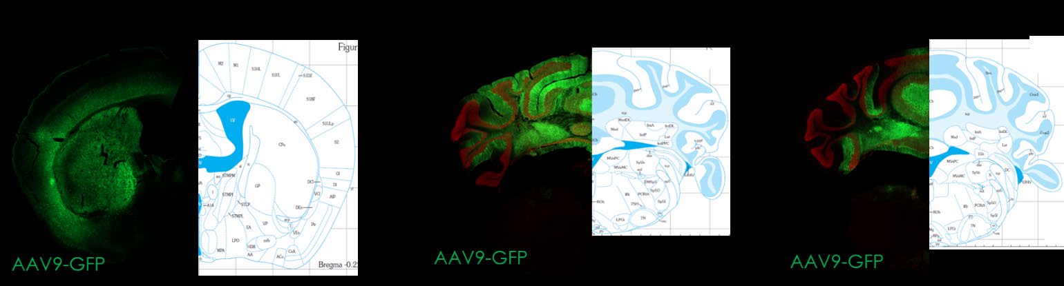 Representative MuriPhys AAV9-GFP distribution examples after striatal, cerebellar and cisterna magna delivery